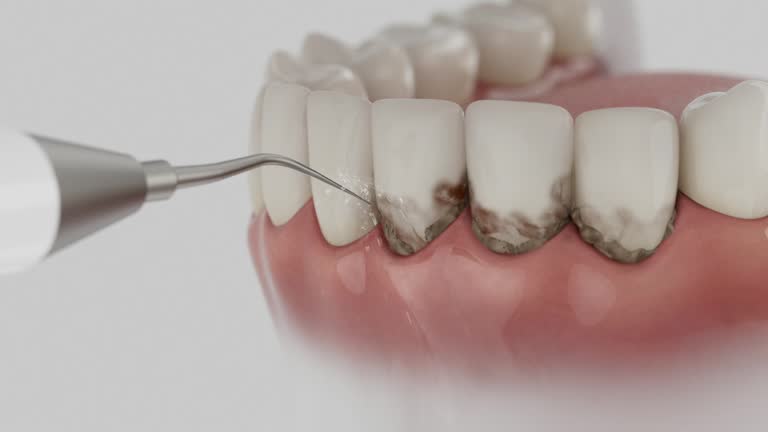 Reliable Dental Implants contractor in Port Orange, FL by Smile Center Dentistry